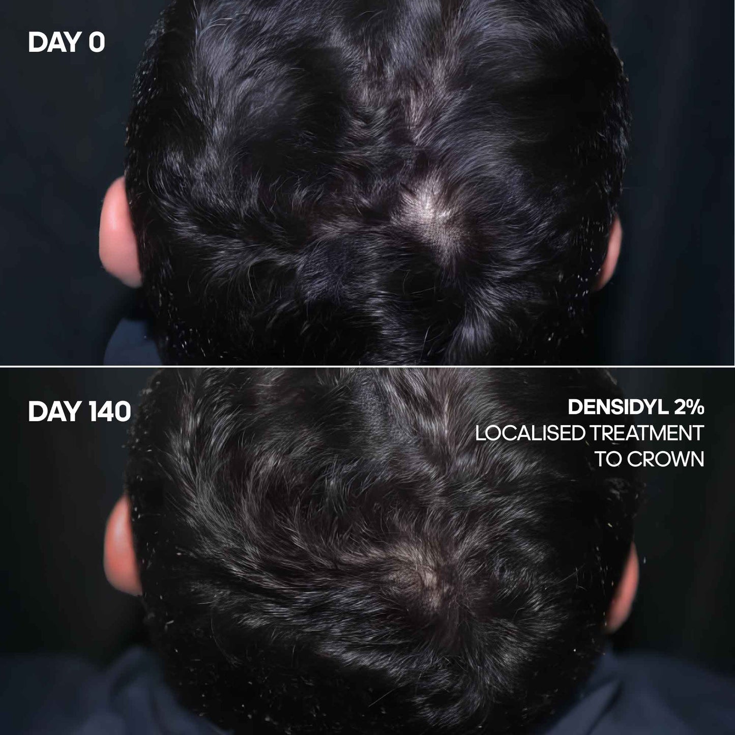 Advanced Hair Growth Serum 60ml